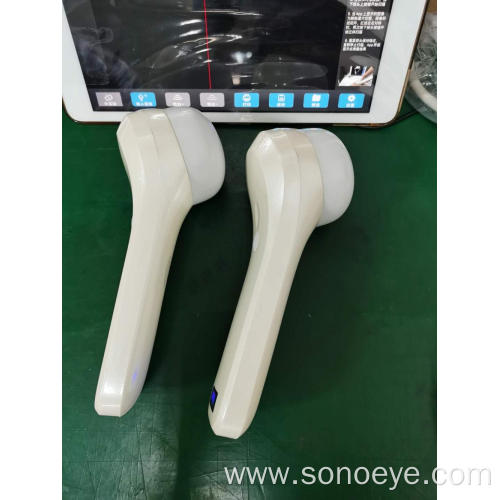 4D handheld Bladder Ultrasound